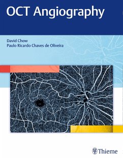 OCT Angiography - Chow, David