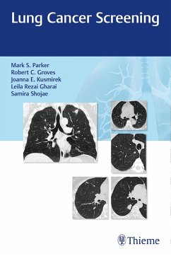 Lung Cancer Screening - Parker, Mark;Groves, Robert;Kusmirek, Joanna