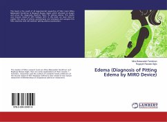 Edema (Diagnosis of Pitting Edema by MIRO Device)