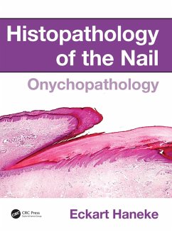 Histopathology of the Nail (eBook, PDF) - Haneke, Eckart