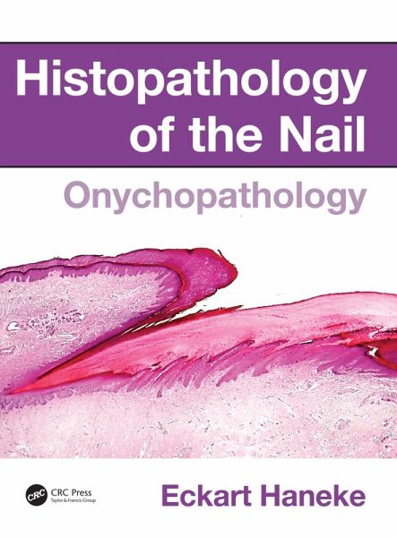 Histopathology of the Nail (eBook, ePUB) Histopathology of the Nail (eBook, ePUB)