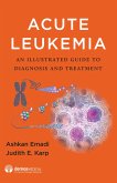 Acute Leukemia (eBook, ePUB)