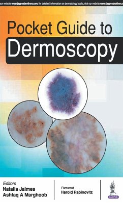 Pocket Guide to Dermoscopy - Marghoob, Ashfaq A.