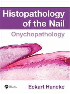 Histopathology of the Nail - Haneke, Eckart (University of Berne, Switzerland)