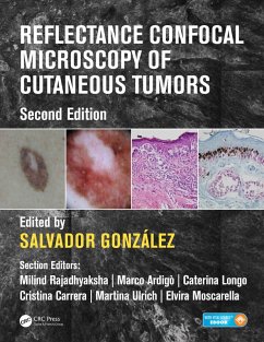 Cover Reflectance Confocal Microscopy of Cutaneous Tumors (eBook, PDF)