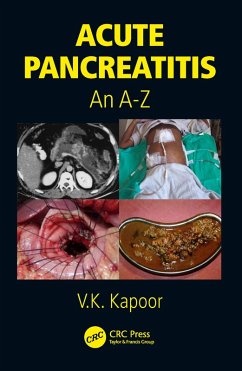 Cover Acute Pancreatitis (eBook, PDF)