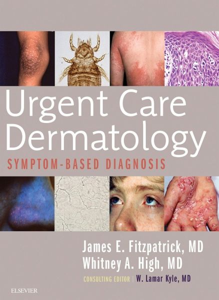 Urgent Care Dermatology: Symptom-Based Diagnosis E-Book (eBook, ePUB) Urgent Care Dermatology: Symptom-Based Diagnosis E-Book (eBook, ePUB)