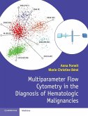 Multiparameter Flow Cytometry in the Diagnosis of Hematologic Malignancies