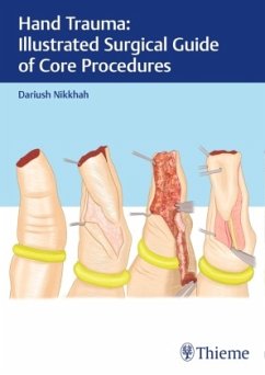 Hand Trauma: Illustrated Surgical Guide of Core Procedures - Nikkhah, Dariush