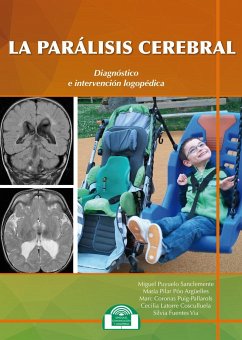 La parálisis cerebral : diagnóstico e intervención logopédica - Puyuelo Sanclemente, Miguel; Puyuelo Sanclemente, Miguel; Latorre Cosculluela, Cecilia