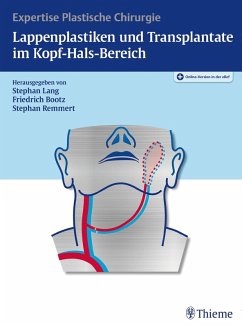 Lappenplastiken und Transplantate im Kopf-Hals-Bereich (eBook, ePUB)