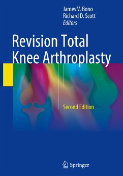 Revision Total Knee Arthroplasty