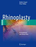 Rhinoplasty