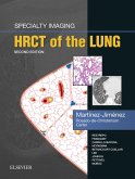 Specialty Imaging: HRCT of the Lung E-Book (eBook, ePUB)