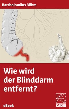 Cover Wie wird der Blinddarm entfernt? (eBook, ePUB)