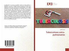 Tuberculoses extra-pulmonaires - Laza, Odilon