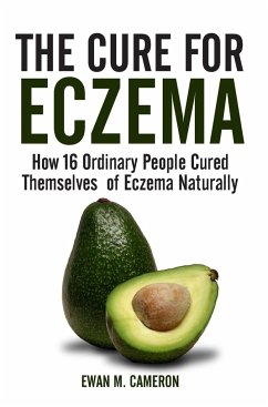 The Cure for Eczema - Cameron, Ewan M.