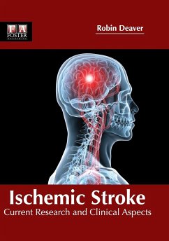 Ischemic Stroke Ischemic Stroke