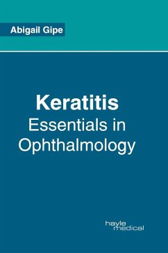 Keratitis Keratitis