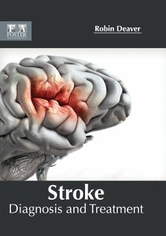 Stroke Stroke