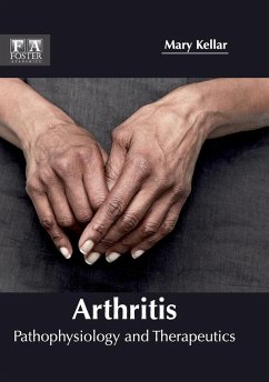 Arthritis Arthritis