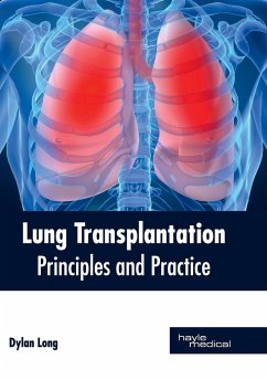 Lung Transplantation: Principles and Practice