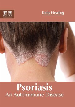 Psoriasis