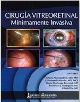 Cover Cirugía Vitreoretinal Mínimamente Invasiva