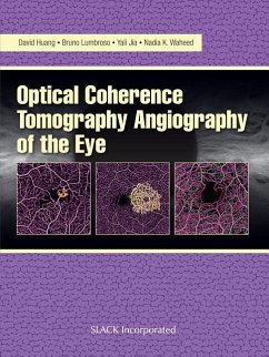 Optical Coherence Tomography Angiography of the Eye - Huang, David; Lumbroso, Bruno; Jia, Yali