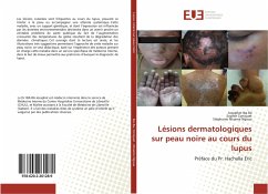 Lésions dermatologiques sur peau noire au cours du lupus - Iba Ba, Josaphat;Coniquet, Sophie;Ntsame Ngoua, Stéphanie
