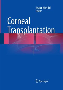 Corneal Transplantation