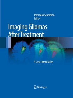 Imaging Gliomas After Treatment