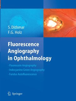 Fluorescence Angiography in Ophthalmology - Dithmar, Stefan;Holz, Frank G.