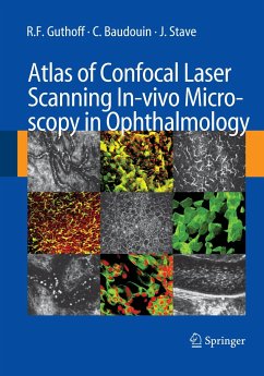 Atlas of Confocal Laser Scanning In-vivo Microscopy in Ophthalmology - Guthoff, R.F.;Baudouin, C.;Stave, J.