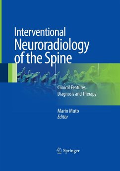 Interventional Neuroradiology of the Spine