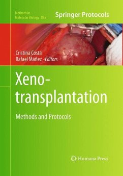 Xenotransplantation