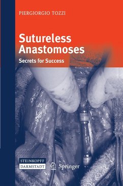 Sutureless Anastomoses - Tozzi, Piergiorgio