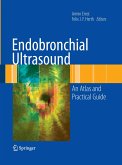 Endobronchial Ultrasound