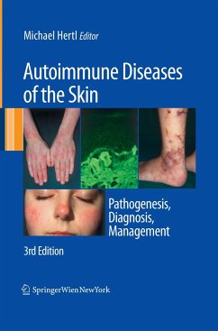 Autoimmune Diseases of the Skin