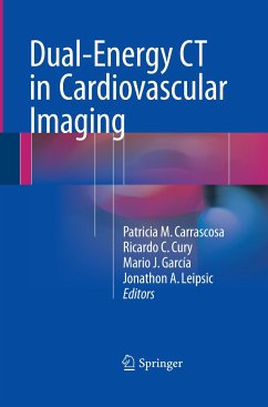 Dual-Energy CT in Cardiovascular Imaging