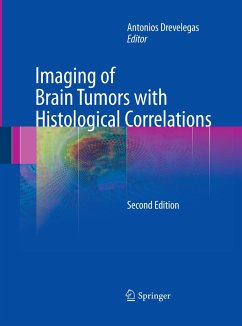 Imaging of Brain Tumors with Histological Correlations