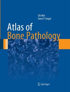 Atlas of Bone Pathology - Wei, Shi;Siegal, Gene P.