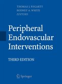 Peripheral Endovascular Interventions