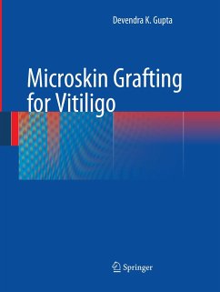 Microskin Grafting for Vitiligo - Gupta, Devendra K.