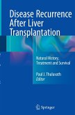 Disease Recurrence After Liver Transplantation
