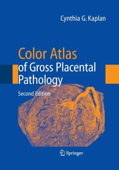Color Atlas of Gross Placental Pathology - Kaplan, Cynthia G.