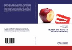 Human Bite marks in Forensic Dentistry