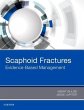 Scaphoid Fractures - Bild 1