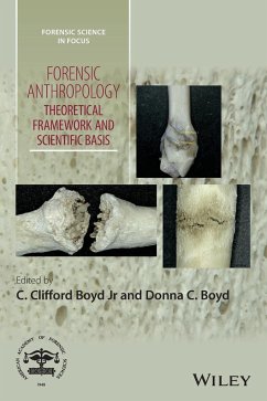 Forensic Anthropology