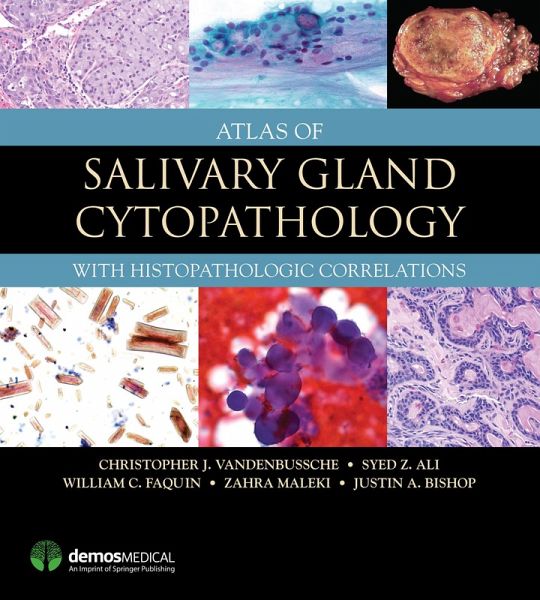 Atlas of Salivary Gland Cytopathology (eBook, ePUB) Atlas of Salivary Gland Cytopathology (eBook, ePUB)